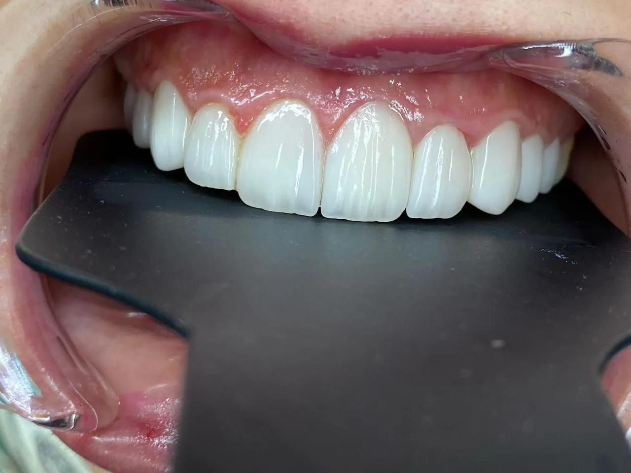 Featured Dental Work