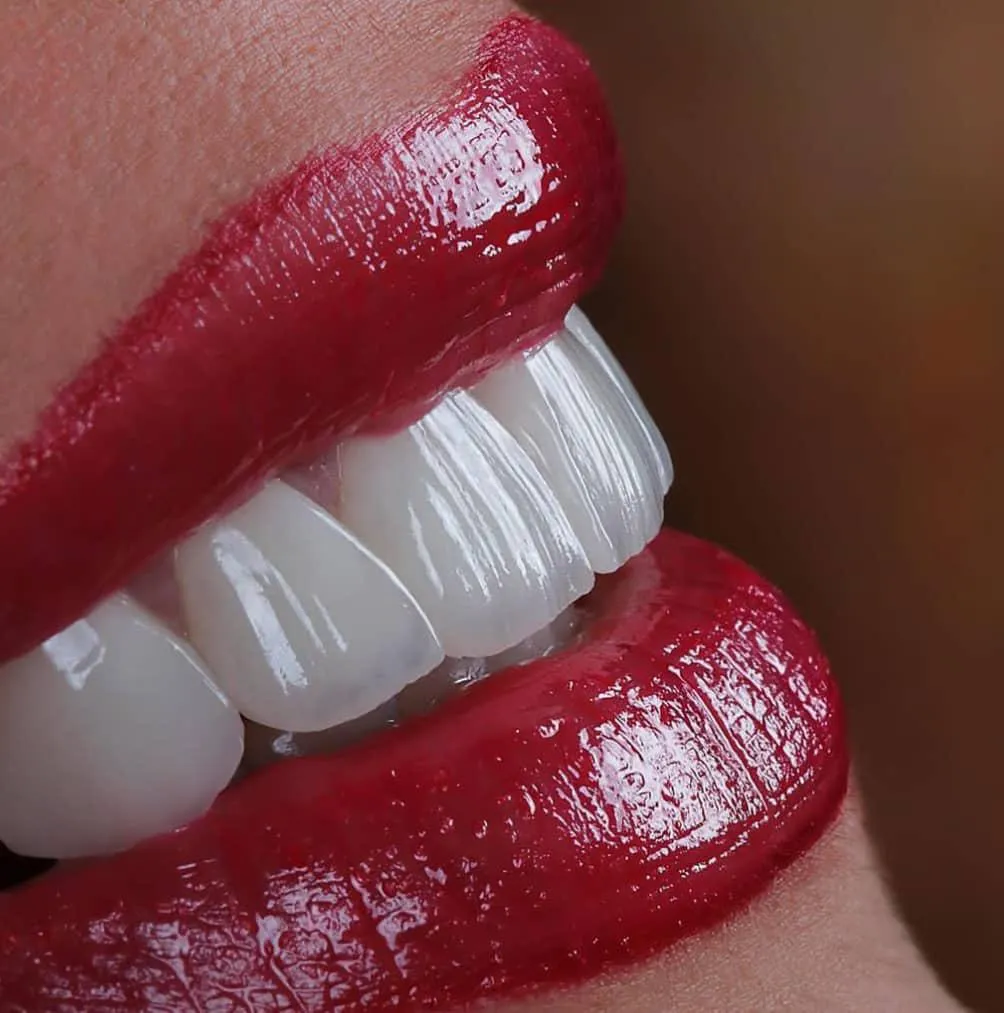 Featured Dental Work